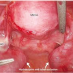chlamydia_2_full_300x300